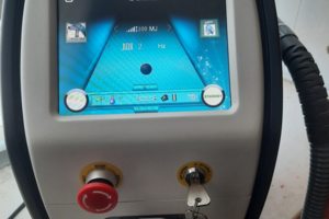 Неодимовый лазер для удаления тату AL1 ND:YAG